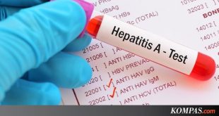 Bisakah Seseorang Tertular Hepatitis Lewat Ciuman? – Kompas.com – KOMPAS.com
