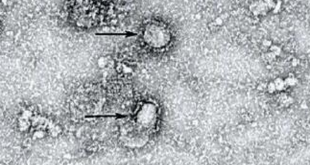 Penampakan Pertama Foto Mikroskop Virus Corona – CNN Indonesia