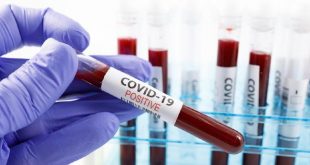 Peneliti Temukan Penyebab Pasien COVID-19 Kehilangan Indra Penciuman – Haibunda
