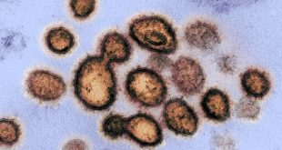 Riset: Virus Corona COVID-19 Kuat, Tangguh dan Tahan Panas Meski di Luar Inang – Liputan6.com